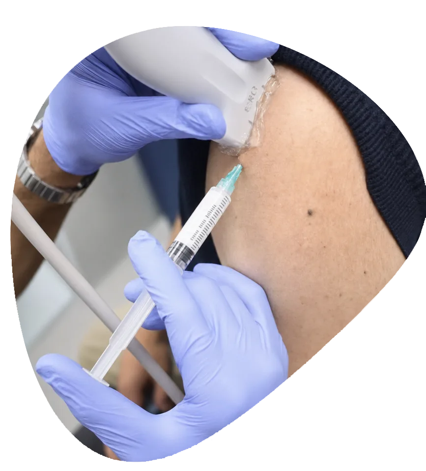 Barbotage for Calcific Tendinopathy