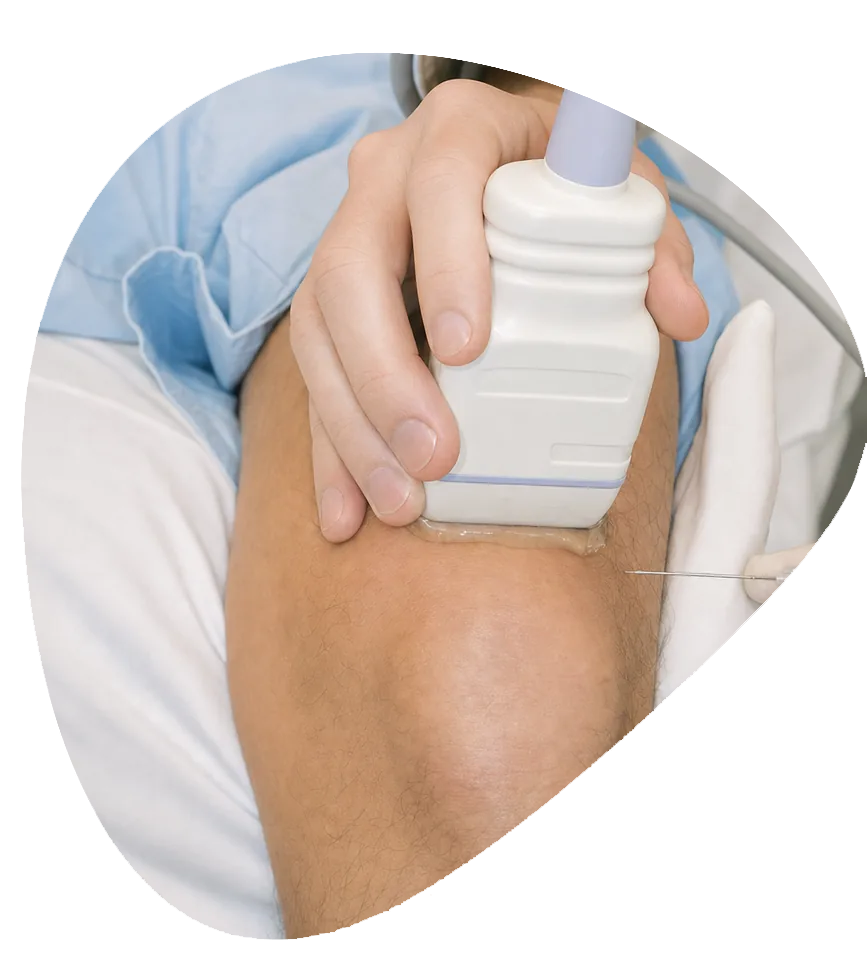 Ostenil Knee Injections