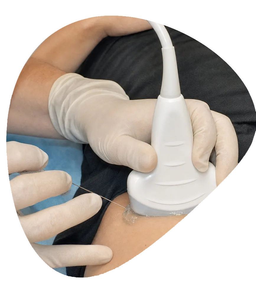 Trochanteric Bursitis Injections