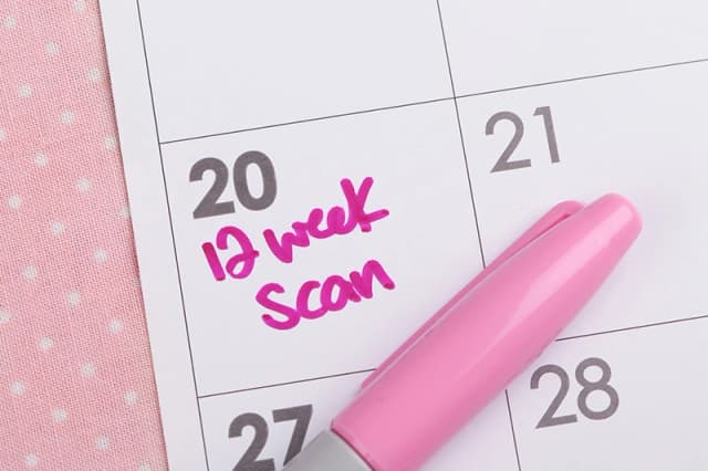 12-week-dating-scan-appointment-calendar-note-harley-street-ultrasound