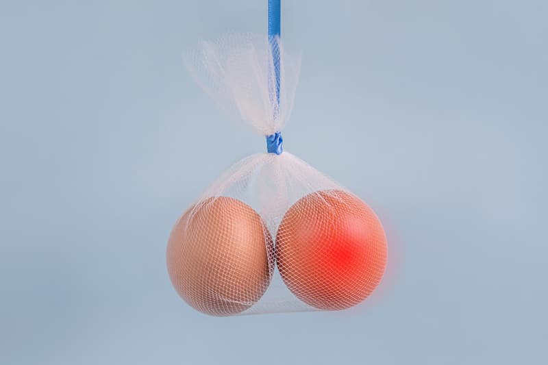 Testicular Cancer What You Need to Know