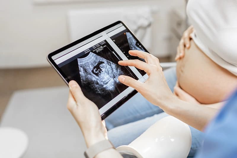 Anomaly Scan / Anatomy Scan: What should you expect?